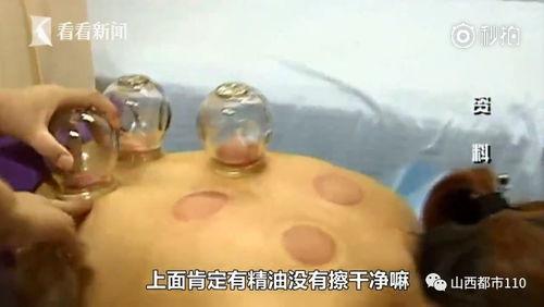 背拔罐视频,居家养生新选择
